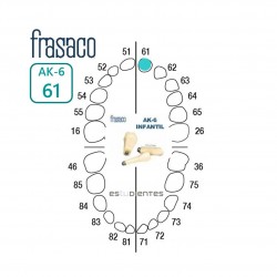 DIENTE AK-6 Nº 61 TIPODONTO...